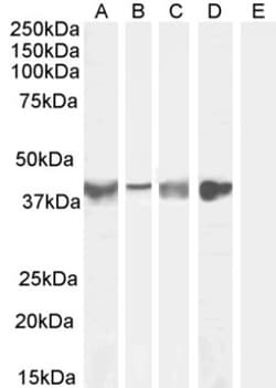 Asporin Antibody, Novus Biologicals 25 &mu;g, Unconjugated:Antibodies,